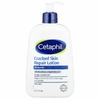 Cetaphil, Лосьон для восстановления потрескавшейся кожи, 473 мл (16 жидк. унц.)